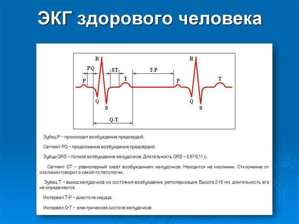 Что делать при тахикардии (быстром биении сердца)?
