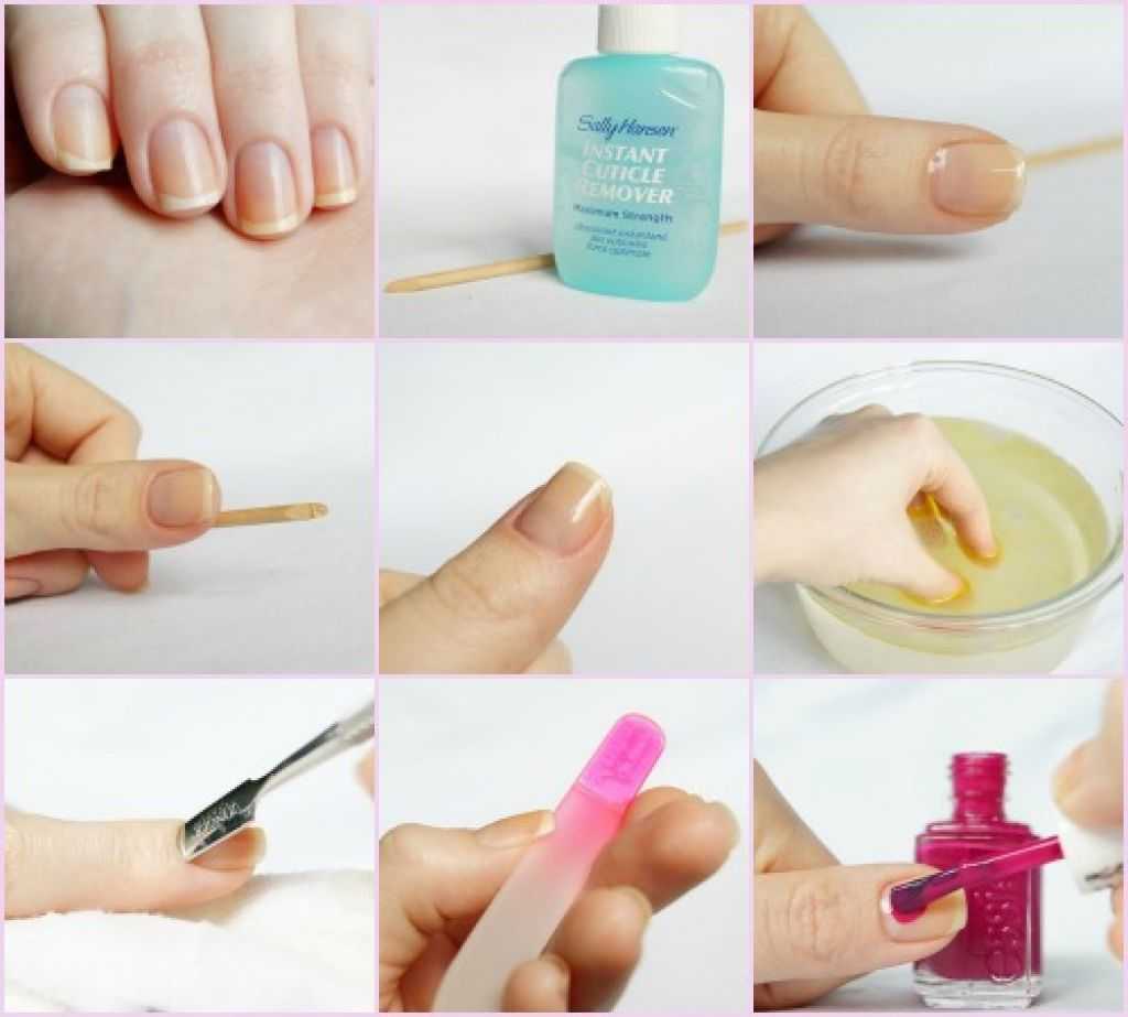 Что делать если у вас сухая кутикула и кожа вокруг ногтей: причины, методы лечения и профилактические меры