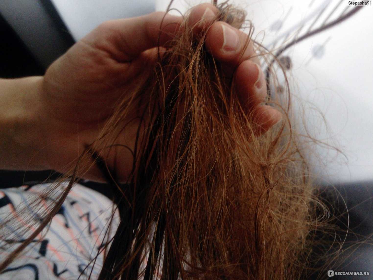 Что делать если волосы сильно